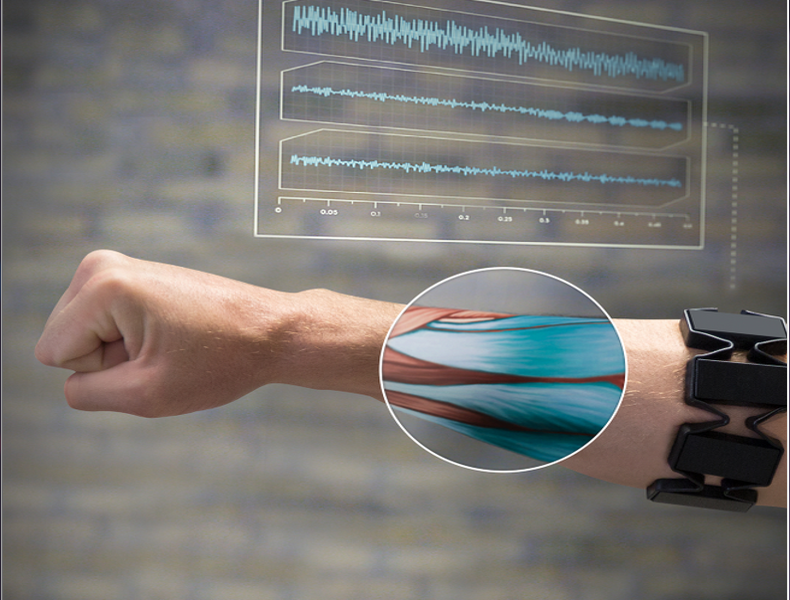 Real Time Control of Hand Prosthesis Using Surface EMG
