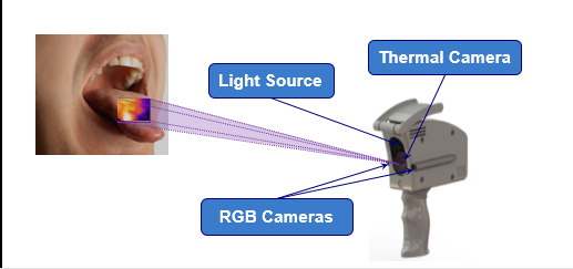 Picture for Early Detection of Cancer Using Thermal Video Analysis