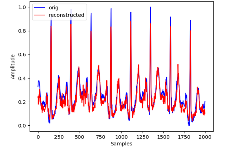 Picture for Compression for Continuous Long-Term Electrocardiography Recordings