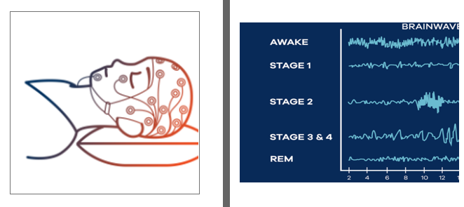 Picture for Neural ODE for Sleeping Stage Identification