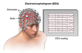 Picture for Hyperbolic Representation Learning for EEG Signals