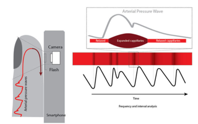 Picture for PPG Signal Acquisition and Analysis