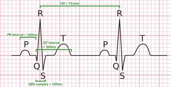 Picture for ECG Analysis Using DL Method