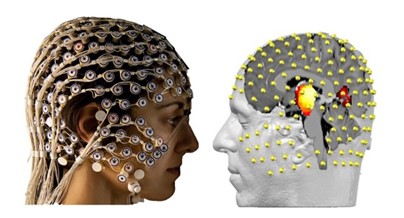 Picture for Prediction of Anesthesia Depth based on EEG Signals