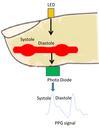 Picture for Blood Pressure Estimation with a Smartwatch