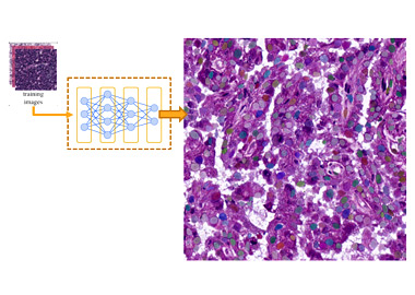 Picture for Areas of Interest Detection in Biopsy Images