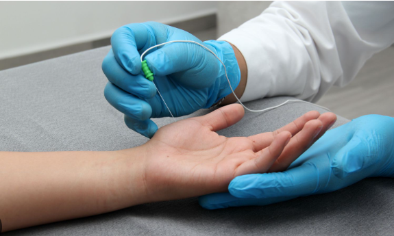 Picture for Detection of nerve root irritation using EMG