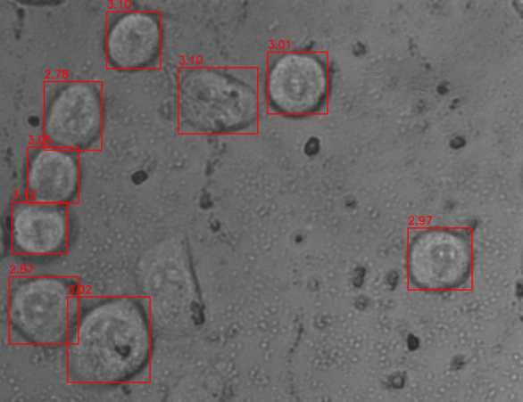 Picture for Depth Estimation Algorithm Of Infiltrating Cancer Cells On A Surface Gel