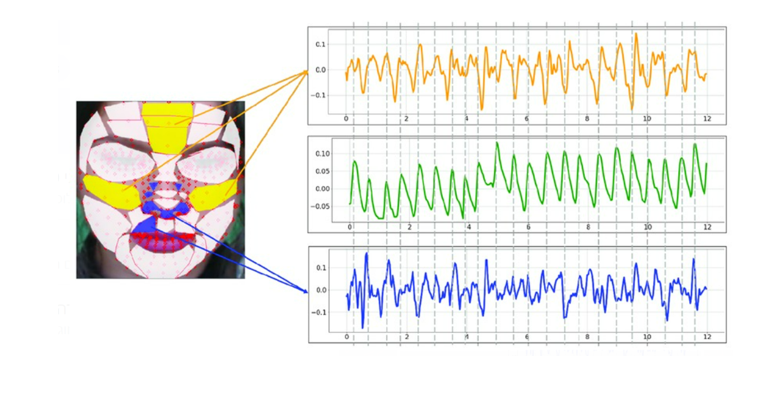 Picture for Heart Rate Estimation Using NIR-Camera Acquired Remote PPG Signal