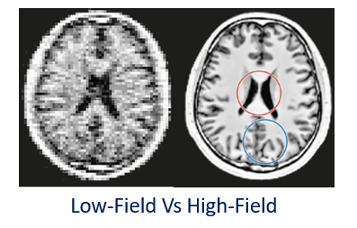 Picture for Low-Field Longitudinal MRI Scans Reconstruction