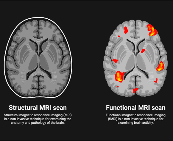 Picture for Linking Childhood Adversity to Brain fMRI Scans