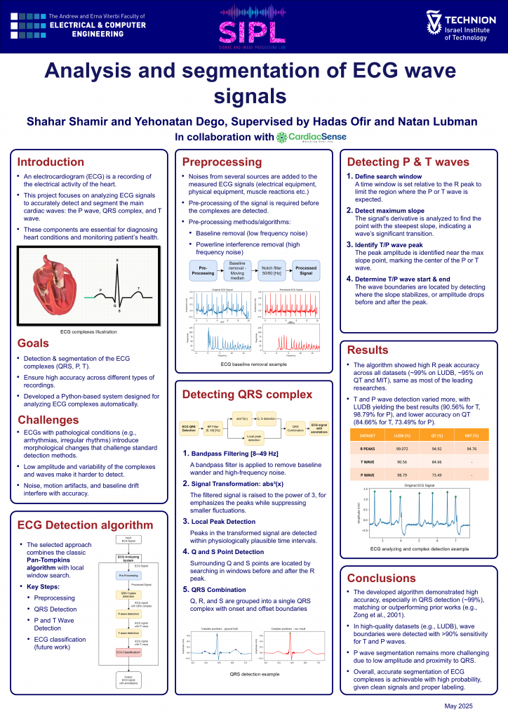 Poster for Analysis and segmentation of ECG wave signals