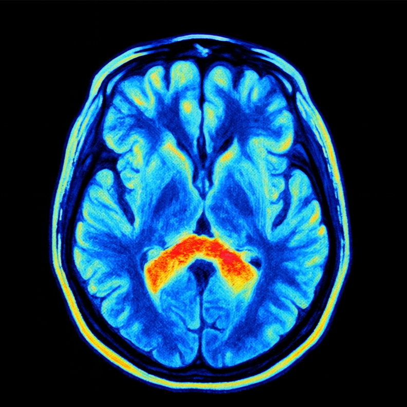 Picture for Linking Childhood Adversity to Brain fMRI Scans